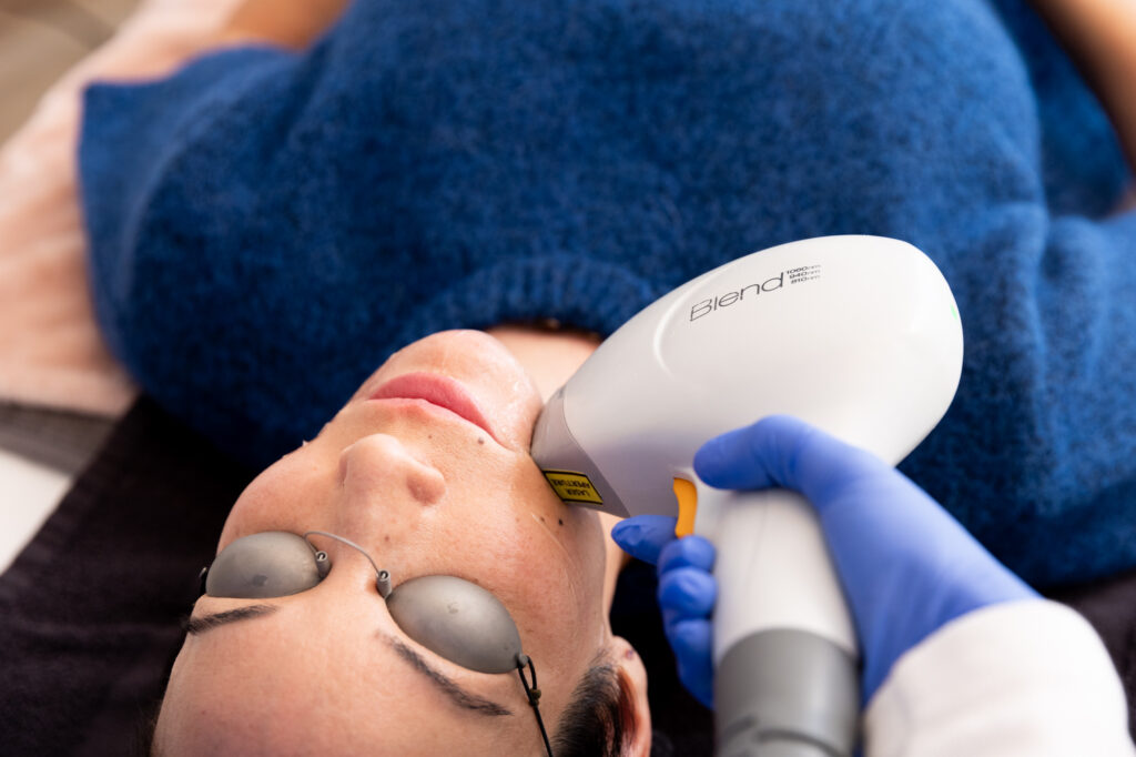 A woman lies down as a Brightside Aesthetics provider glides the Primelase device across her skin for laser hair removal near West Des Moines.
